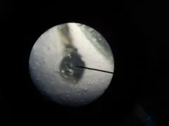 Multicolored Bark Crab Spider thumbnail 4