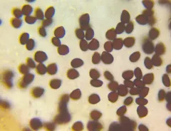 Milky Inkcap thumbnail 3