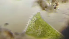 Stentor polymorphus thumbnail 2