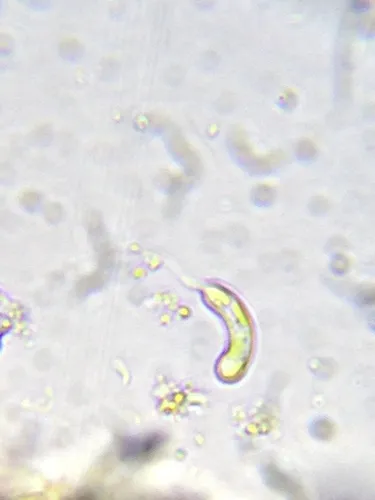 Ophiocytium cochleare