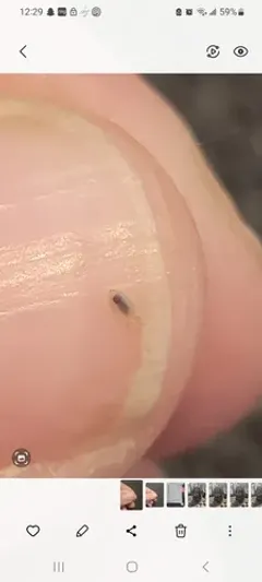 Dog Sucking Louse thumbnail 3