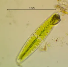 Netrium digitus thumbnail 4