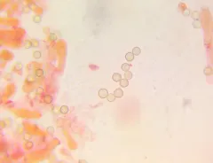 Crepidotus malachius thumbnail 2