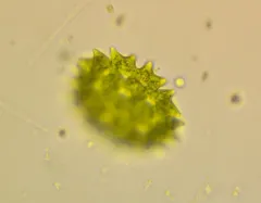 Pseudopediastrum cornutum thumbnail 2