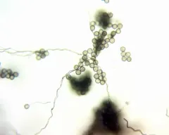Diderma radiatum thumbnail 3
