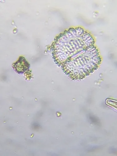 Cosmarium caelatum