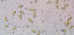 Pseudosperma niveivelatum thumbnail 3