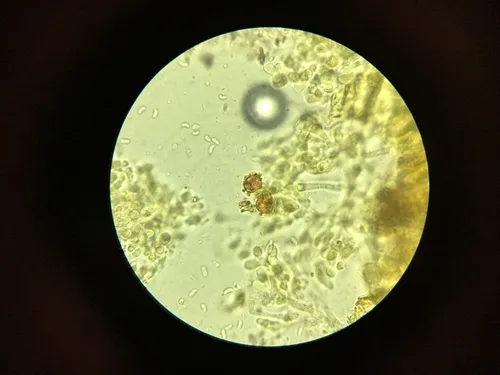 Sistotrema sernanderi
