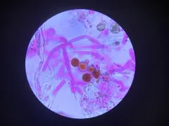 Botryobasidium vagum thumbnail 2