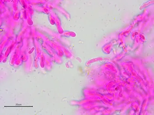 Galzinia incrustans
