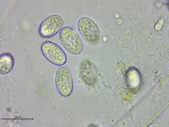 Scutellinia crinita thumbnail 3