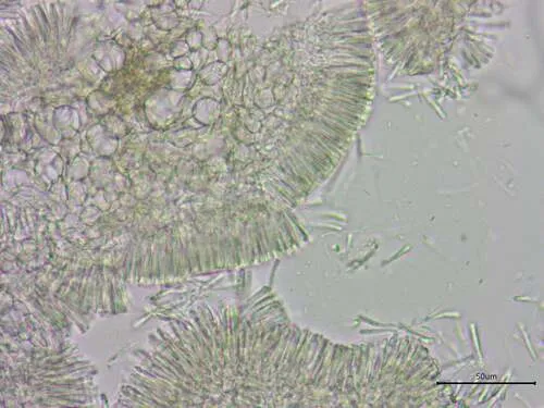Orbilia epipora