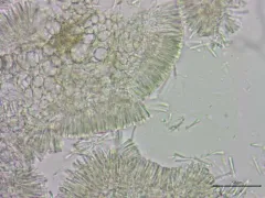 Orbilia epipora thumbnail 1