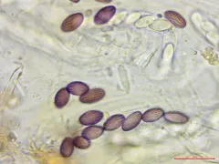 Ascobolus crenulatus thumbnail 2