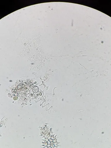 Planktolyngbya contorta