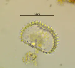 Cosmarium eloiseanum thumbnail 2