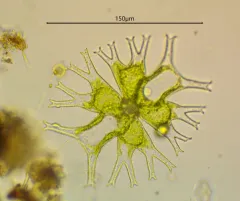 Micrasterias furcata thumbnail 4