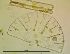 Micrasterias denticulata thumbnail 4