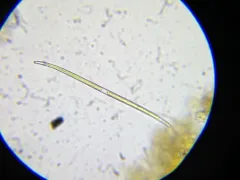 Closterium limneticum thumbnail 2