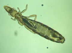 Slender pigeon louse thumbnail 3