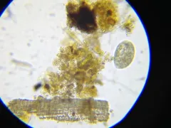 Frontonia acuminata thumbnail 3