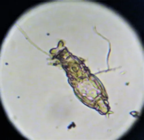 Macrotrachela plicata