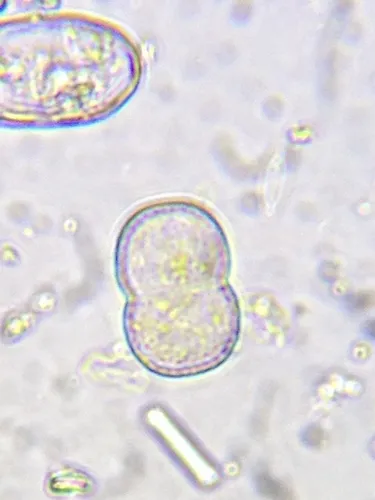 Actinotaenium cucurbita