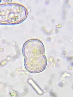 Actinotaenium cucurbita thumbnail 1