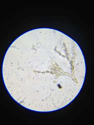 Batrachospermum gelatinosum