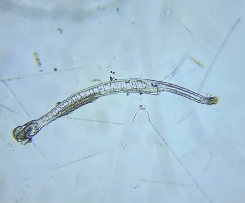 Parasagitta elegans