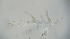 Dinobryon cylindricum thumbnail 2