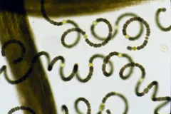 Dolichospermum spiroides thumbnail 3