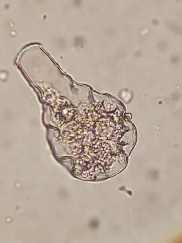 Hyalosphenia elegans