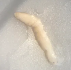 Broad Tapeworm thumbnail 4
