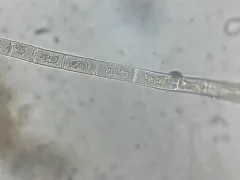 Zygogonium ericetorum thumbnail 2