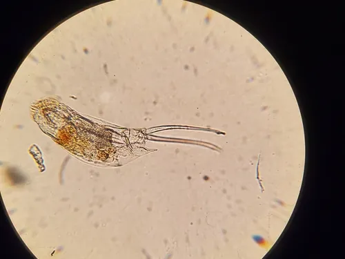 Cephalodella mucronata