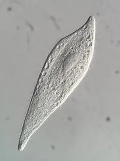 Amphileptus pleurosigma thumbnail 2