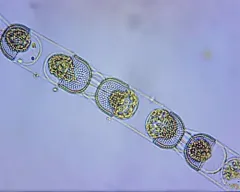 Stephanopyxis nipponica thumbnail 3