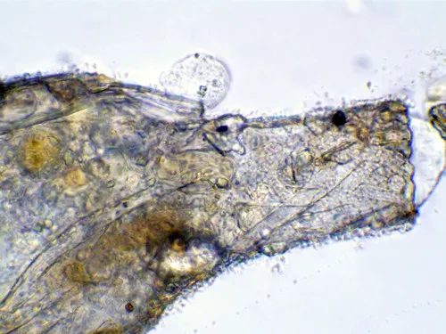 Difflugia bacillifera