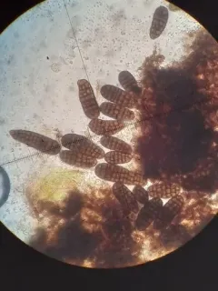 Berkleasmium concinnum thumbnail 2