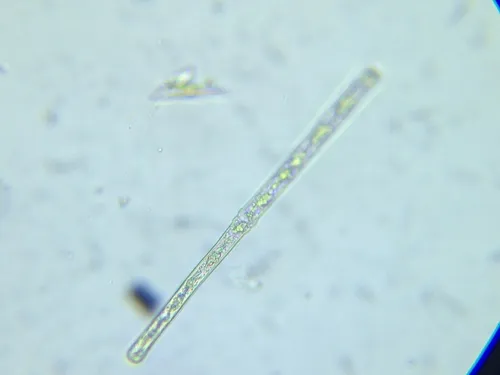 Haplotaenium rectum