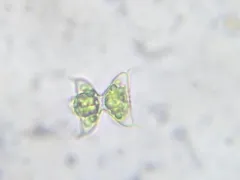 Staurodesmus dejectus thumbnail 1