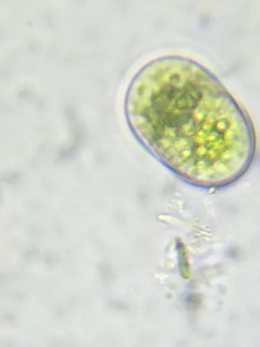 Cylindrocystis crassa