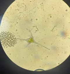 Ceratium hirundinella thumbnail 3