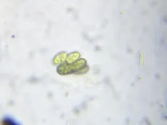 Scenedesmus obtusus thumbnail 4