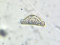 Epithemia sorex thumbnail 3