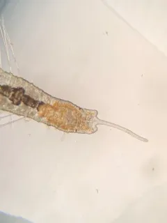 Stylaria lacustris thumbnail 3
