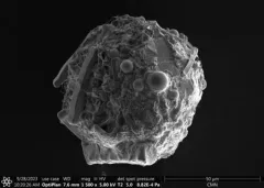 Difflugia brevicolla thumbnail 1