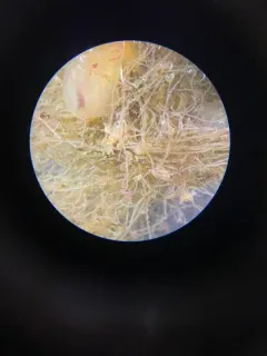 Naked Ear Aeolid thumbnail 2