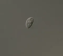 Cyclidium glaucoma thumbnail 1